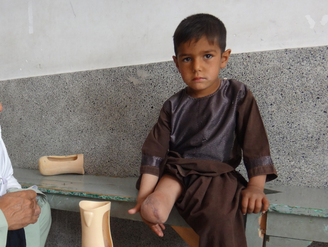 Enayatullah lost his leg after stepping on an explosive
