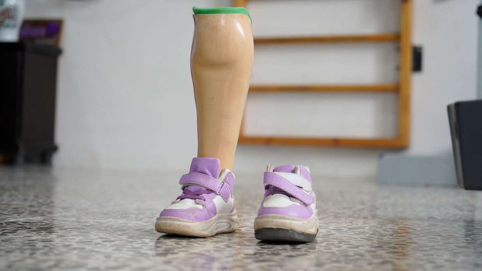 prosthetic leg