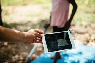 Scanning of a limb to prepare the 3D device © Q. Neely / HI