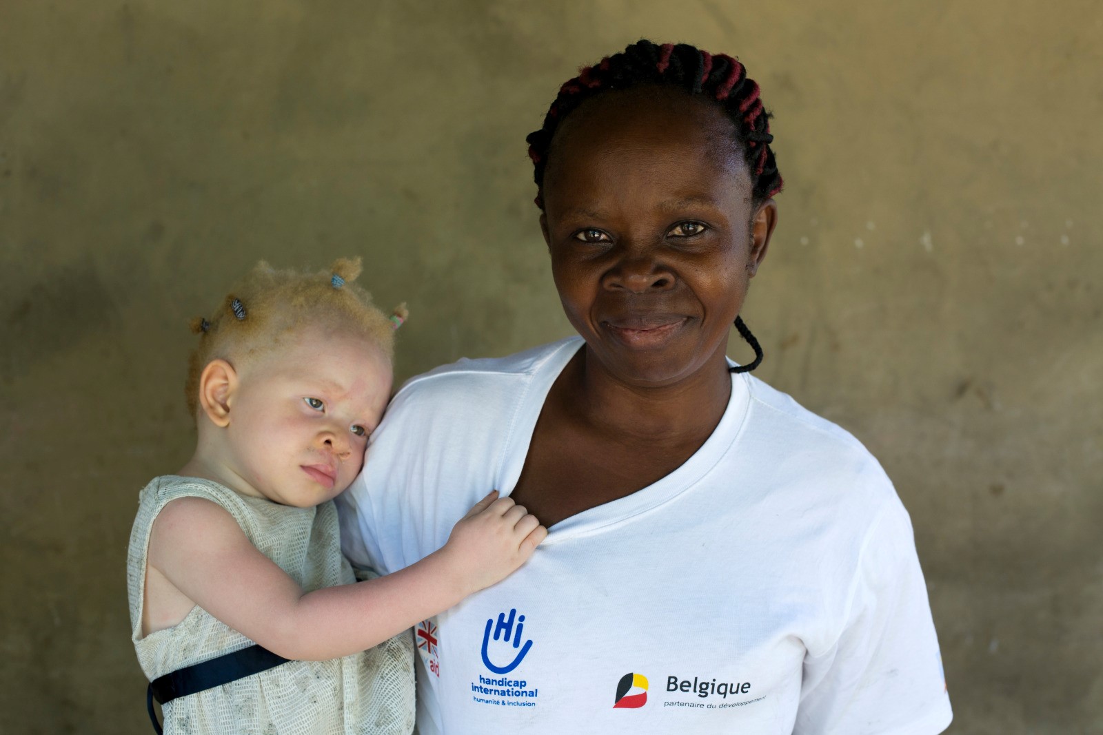 Helene (35) carries her one and a half year old daughter Marie Helen, who has albinism. Kinshasa, DRC. 2019 © Karel Prinsloo/HI