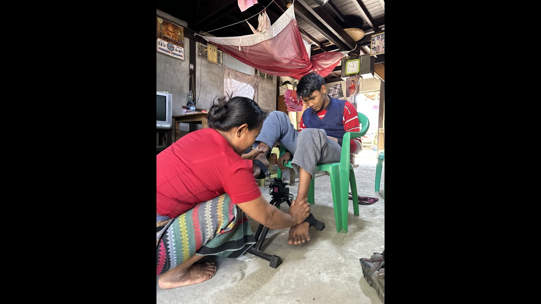 In a living room with a cement floor, a person is crouching down, adjusting a device positioned at the foot and ankle of another person sitting on a green plastic chair. The seated person has their legs stretched out in front of them and is watching the procedure. The background shows concrete walls decorated with calendars and pictures, a television set on a piece of furniture, and several pieces of fabric hanging from the ceiling.