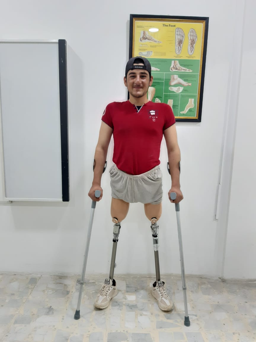 Ismail is pleased with his new prostheses 