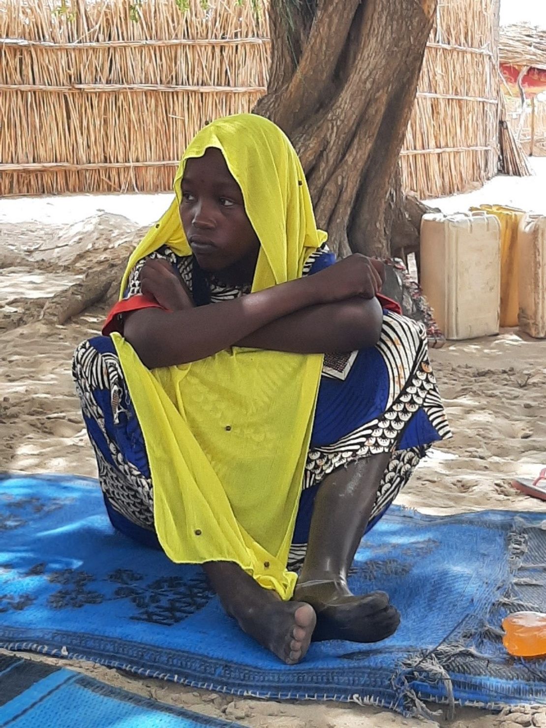 Hawa with her new prosthesis.