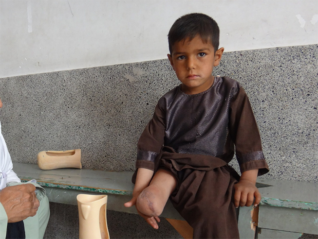 Enayatullah lost his leg after stepping on an explosive