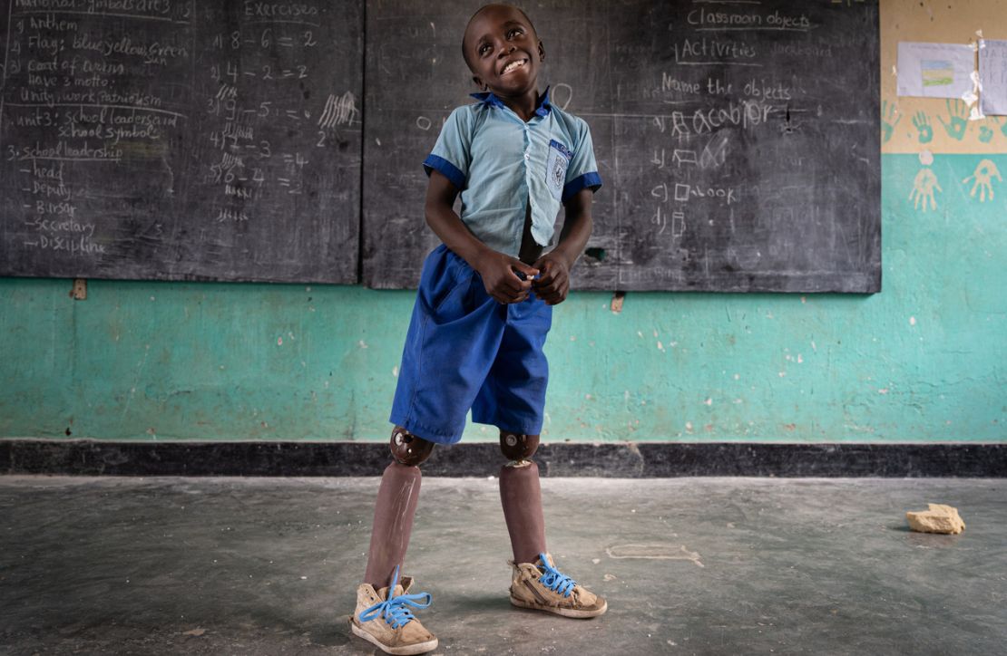 Longini standing in his class using his prosthetics