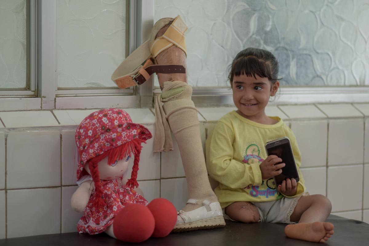Hala sitting with her prosthesis and a doll during a rehabilitation session in Yemen