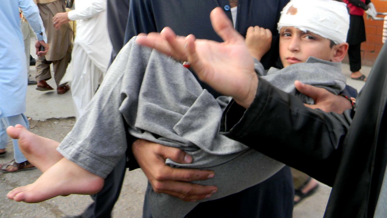 A child injured in the earthquake