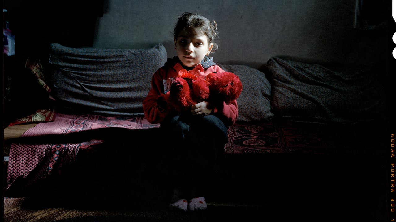 Sondos, 8, ws injured in a bombing on her school in Syria.; }}
