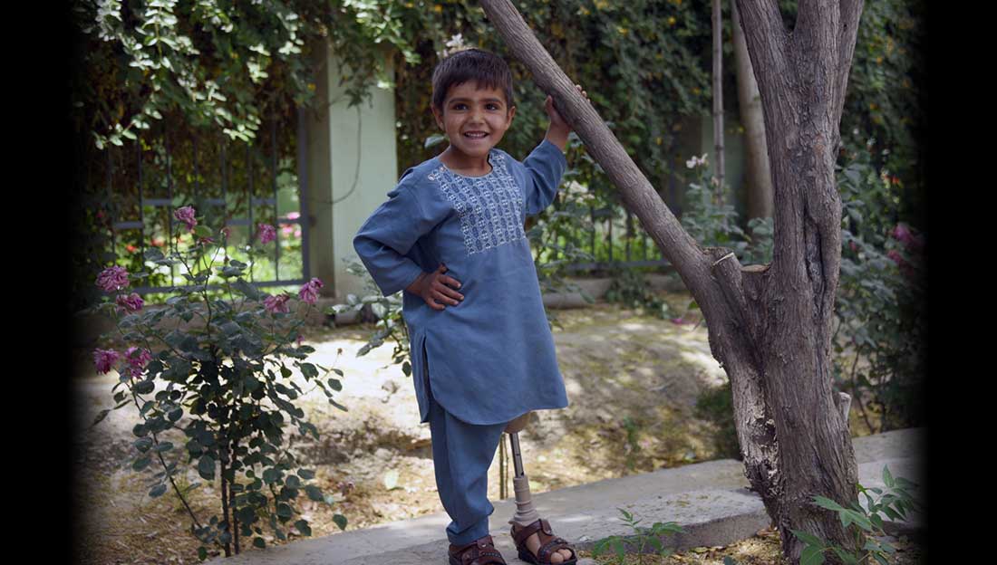 Sanaullah, 5, standing next to a tree wearing his prosthetic leg from HI. He lost his leg to a mortar in Afghanistan.
