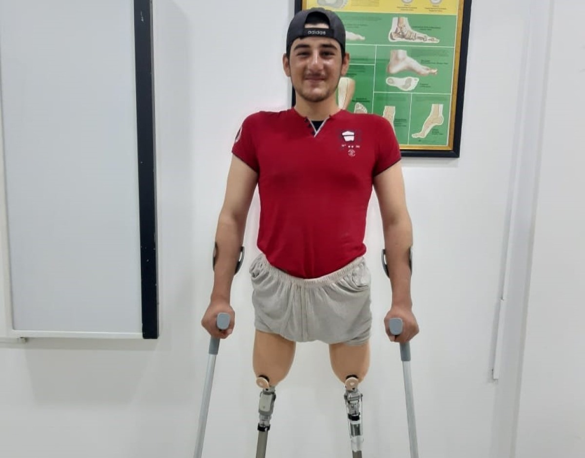 Ismail is pleased with his new prostheses ; }}