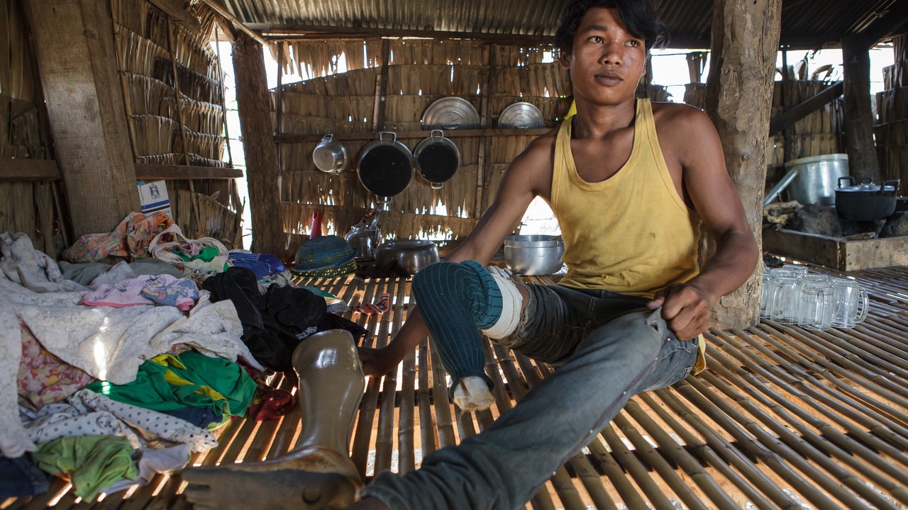 Nak, 17, landmine survivor and future motorbike mechanic. Cambodia.; }}