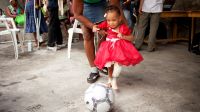 Blaurah, 17 months, tries playing football with her first prosthesis with the help of her mother, at an orthopaedic centre in Haiti.; }}