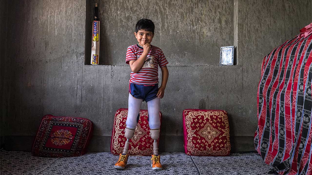 Fayaz, 5, standing up using his artificial legs, Kashmir; }}