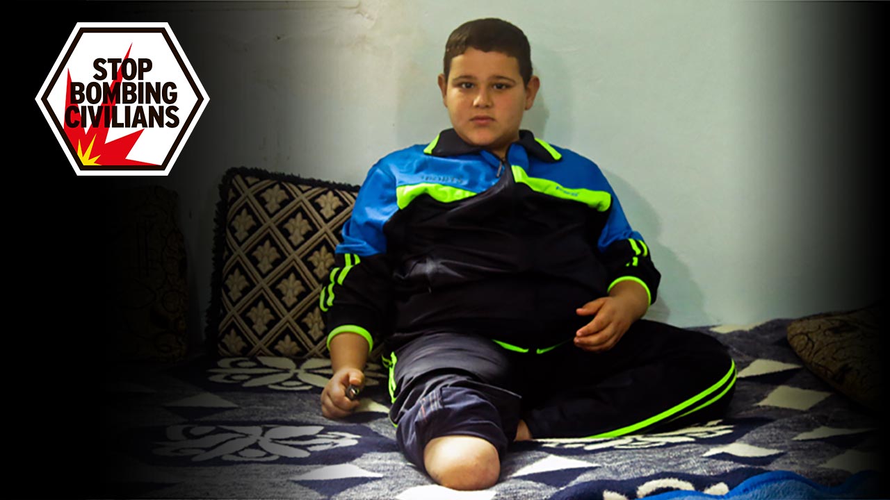 Mohamaed, 9, who lost his leg in a bombing in Syria