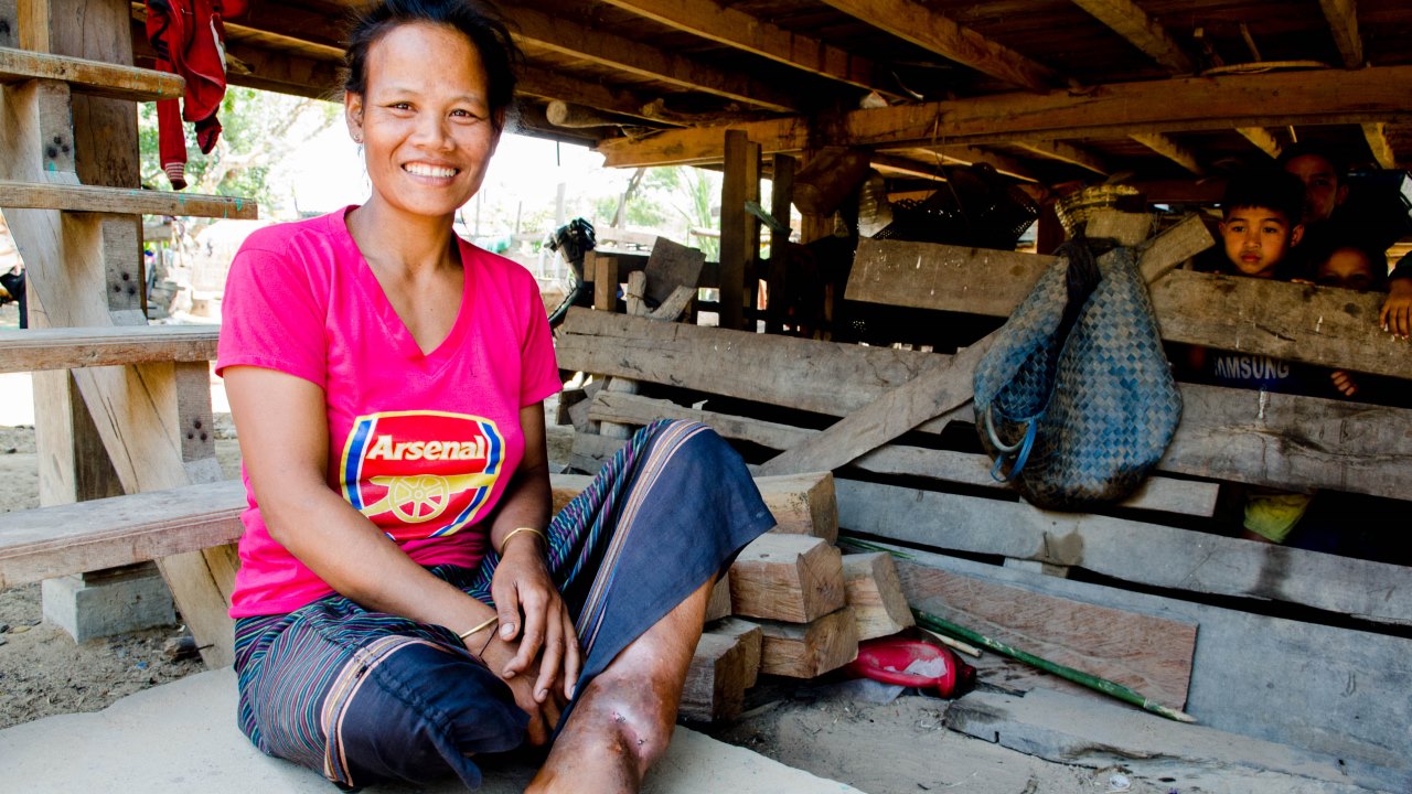 Nang sits outside her home, with her leg injury visible. ; }}