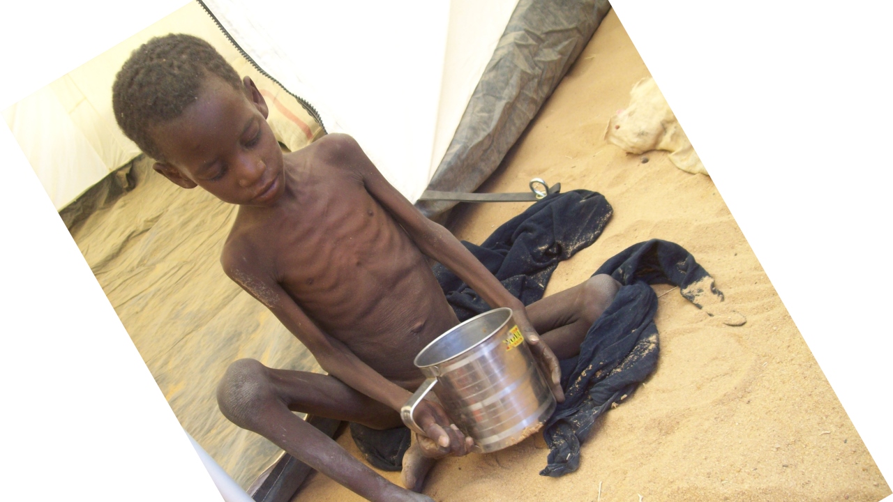 A malnourished child refugee found during an evaluation mission in the Abala camp north of Niamey, Niger.; }}