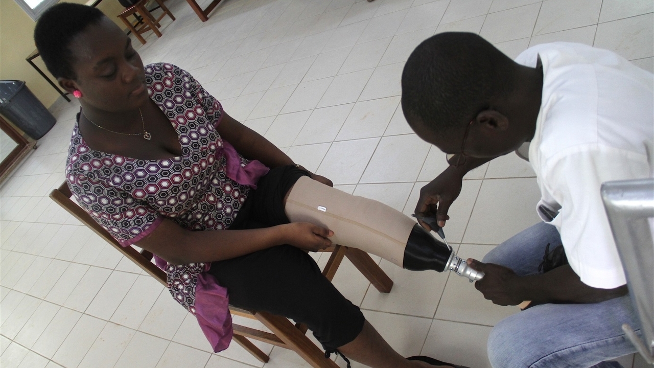 A trial participant receives her bespoke 3D printed socket; }}